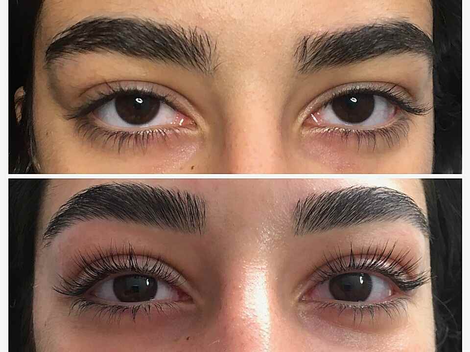 Kirpik Lifting Uygulaması