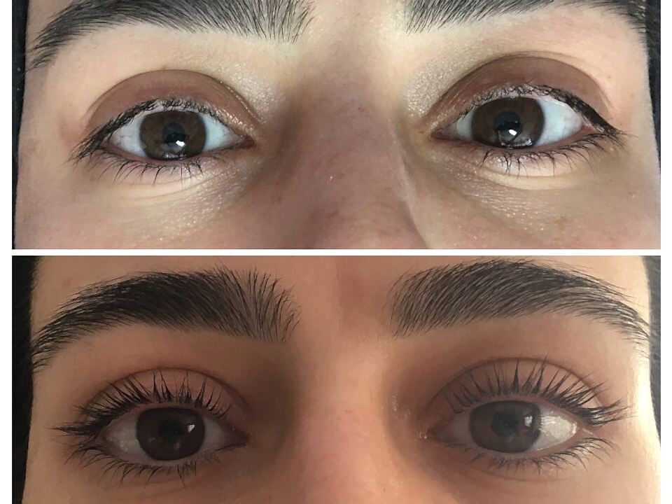 Kirpik Lifting Uygulamamız