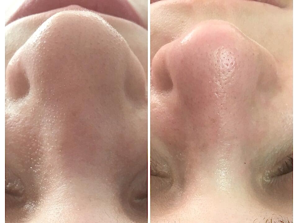 Cilt Bakımı İşlemlerimiz